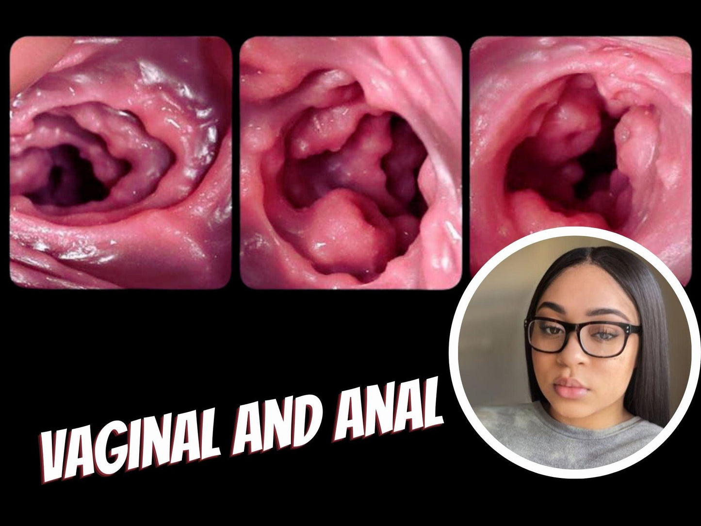 Wynter's Ass Fantasy Sex Toy, fleshlights for men, Fleshlights Nude, Gifts For Him, Lgbtq Stroker Adult, Masturbation Man Men, Masturbator Men, mature, Mouth Realistic, Realistic Anal Sex, Ribbed Masturbator, Toy Transparent, Vaginal And Anal Toy