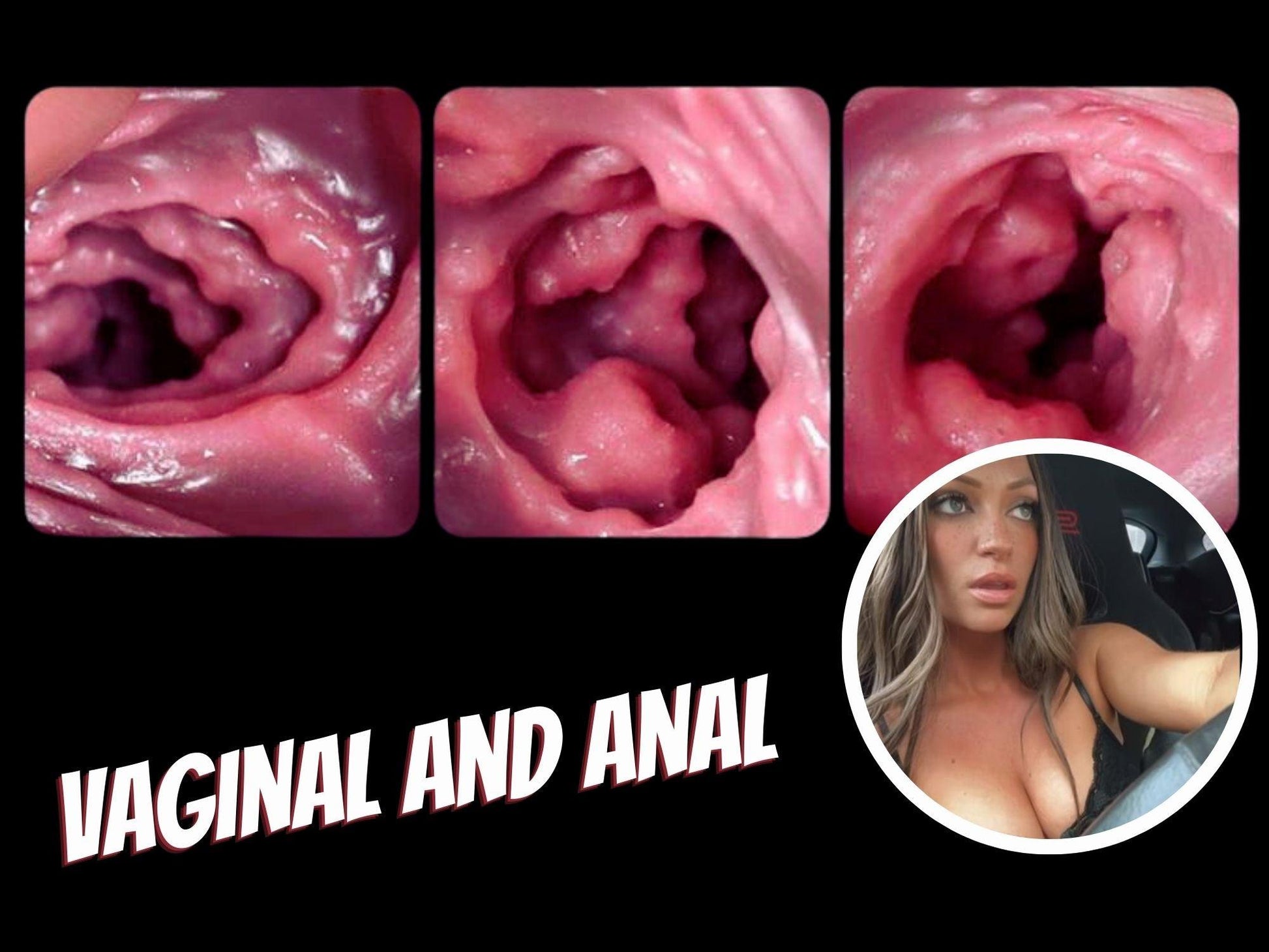 Casey Mae's Pussy Fantasy Sex Toy, fleshlights for men, Fleshlights Nude, Gifts For Him, Lgbtq Stroker Adult, Masturbation Man Men, Masturbator Men, mature, Mouth Realistic, Realistic Anal Sex, Ribbed Masturbator, Toy Transparent, Vaginal And Anal Toy